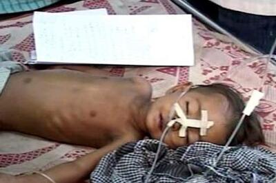 West Bengal: No Eid holiday for health workers