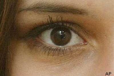 Centenarian pledges to donate eyes