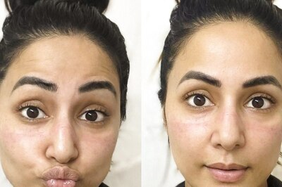 Hina Khan's Entire Family Tests Covid Positive; Actor Posts Pics of 'Scars' After Wearing Masks 24x7