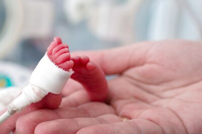 No Increase in Preterm Births or Stillbirths During The First Year of the COVID-19 Pandemic, Says Study