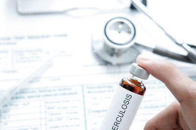 Centre's Mathematical Model Shows Tuberculosis Cases, Deaths Lower Than Yearly WHO Estimates