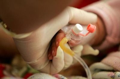Anesthesia Does Not Lower IQ In Children: Study