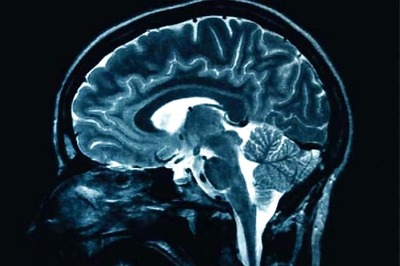 Happiness is located in parietal lobe of your brain