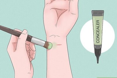 How to Hide Self Harm Scars