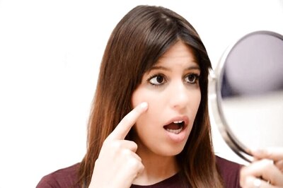 Here Are a Few Easy Ways to Get Rid of Dark Circles