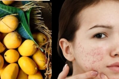 Expert Shares If Eating Mangoes Causes Pimples On Face