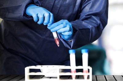 Goa Health Services Director Tests Positive for Covid-19, Admitted to Hospital