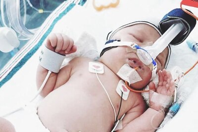 Two-days-old Baby Becomes Millionaire With Rs 52 Crore Trust Fund, Here is How