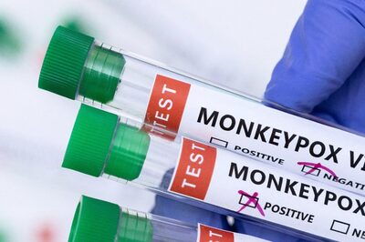 Is Monkeypox a Global Threat? Does it Spread Primarily Through Sexual Contact? Top WHO Official Answers