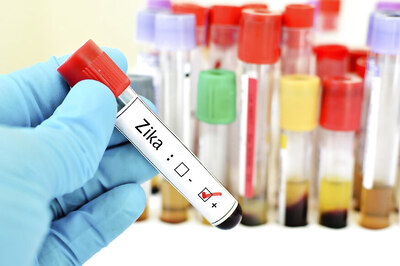 FDA Authorises New Diagnostic Test That Can Detect Signs of Zika Infection Within 12 Weeks