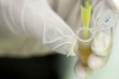 Andhra University VC Says Kauravas Were Test Tube Babies. There's More on Ramayana Too