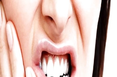 Six Home Remedies To Prevent Receding Gums