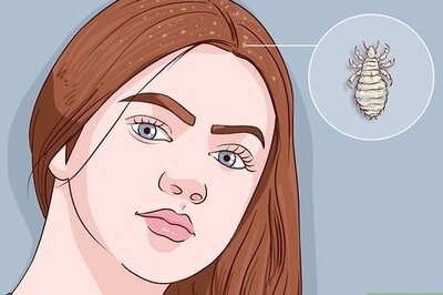 How to Remove Nits from Hair