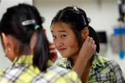 Hollywood-style special effects give girl new ear