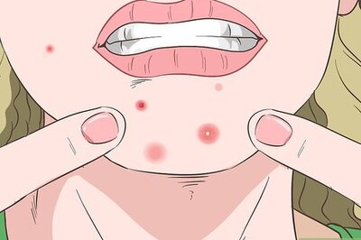 How to Recognize Staph Infection Symptoms