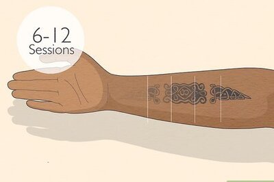 How Many Laser Removal Sessions Do You Need for Your Tattoo?