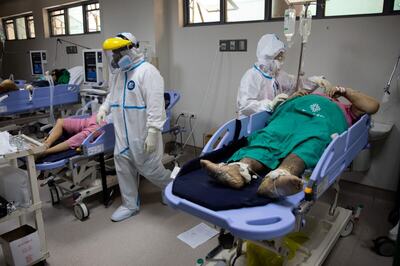 Anti-inflammatory Drug May Shorten Covid-19 Recovery Time, Study Reveals