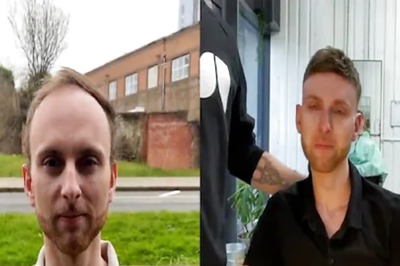 Video Of Bald Man's Hair Transformation Takes Internet By Storm