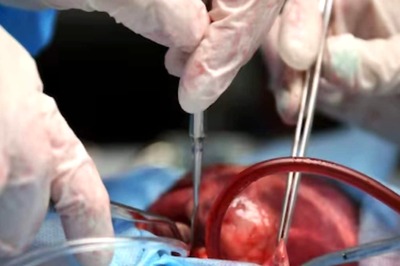 US Fitness Influencer Undergoes Surgery After Tool Falls Inside His Heart