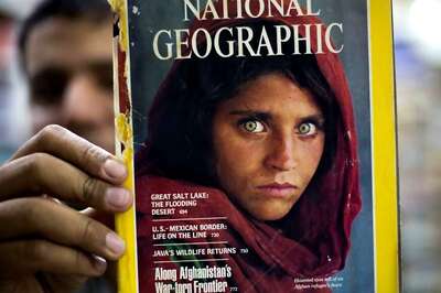 Nat Geo’s Afghan Girl Hospitalised In Pakistan