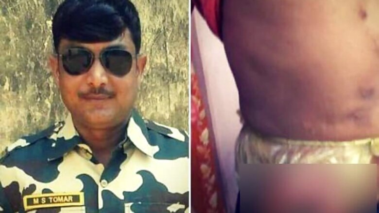 CRPF Jawan Forced to Carry Intestine in Polythene Bag After Surviving Naxal Attack in 2014