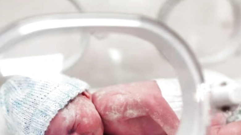 Genetic And Structural Abnormalities: Understanding Key Reasons For Preterm Birth