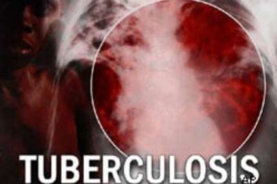 TB still threat to the world, says WHO