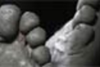 Groom burnt alive for ‘not washing feet’