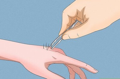 How to Remove Cactus Needles