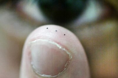 Upset About Peeling Fingertips? Here's What You Need to Do