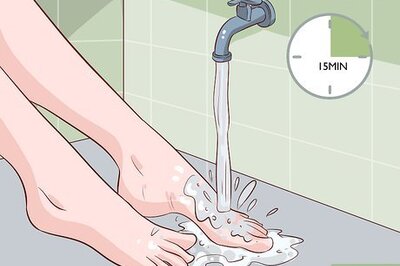 How to Treat a Foot Burn