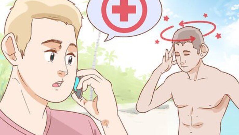 How to Treat Sun Poisoning