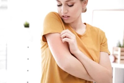 Follow These Home Remedies To Get Rid of Itching in Monsoon