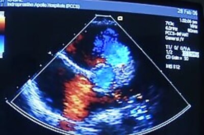 Heart disease reversed in noble trial