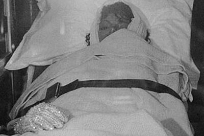 Video of Jackson's hair on fire surfaces after 25 years