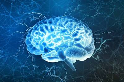 Genes Alone Won't Determine Alzheimer's Risk