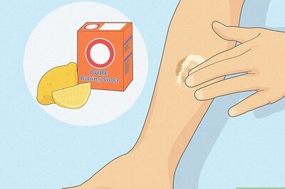 How to Get Rid of Ringworm Scars