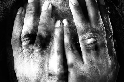 College Student Attacked with Acid for Rejecting Marriage Proposal in Assam