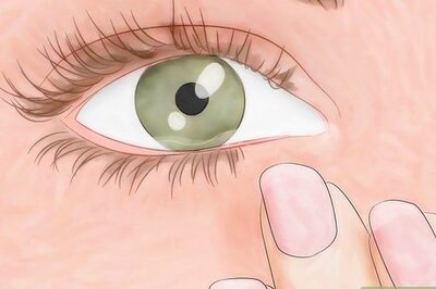 How to Diagnose & Get Rid of Eyelash Mites
