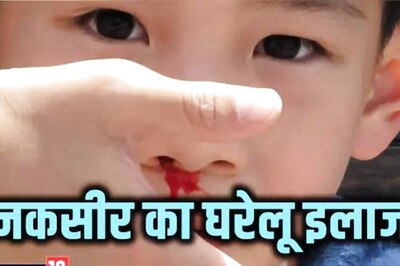 Vinegar to Steam, Easy Hacks to Prevent Nose Bleeding in Summers