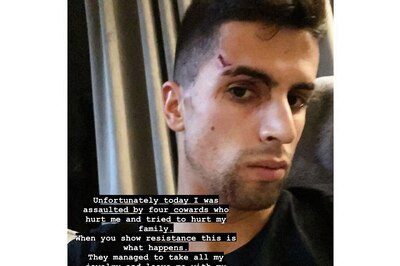 Manchester City Defender Joao Cancelo Assaulted During Robbery at Home