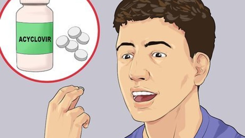 How to Live with Herpes