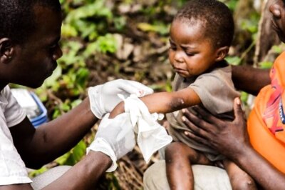 100 cases, 12 countries: Symptoms to Vaccine, Here’s All You Need to Know about Monkeypox Virus