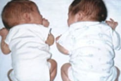 Battle of the sexes begins before twins' birth
