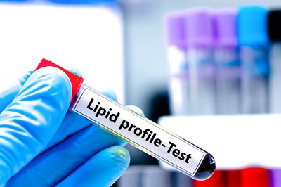 Gift Yourself a Lipid Profile Test Every Birthday or Anniversary and Learn to Read the Results | Health Matters