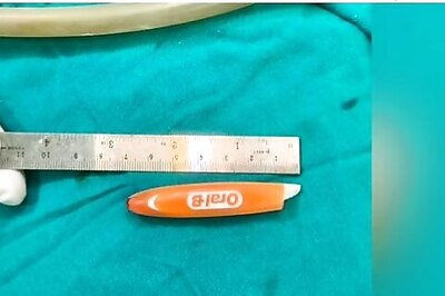 Toothbrush Gets Stuck Under Woman's Eye, Successfully Removed Surgically in Karnataka