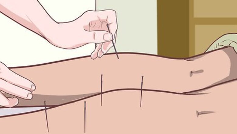 How to Treat Fibromyalgia with Acupuncture