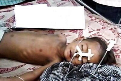 Three more children succumb to encephalitis in Gorakhpur