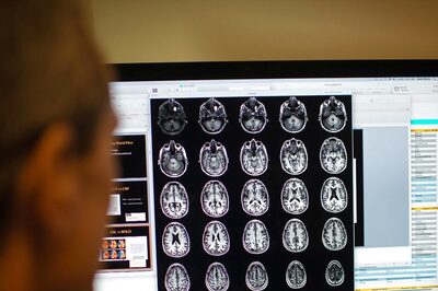 Recognizing Early Signs of Alzheimer's Disease in Older Adults