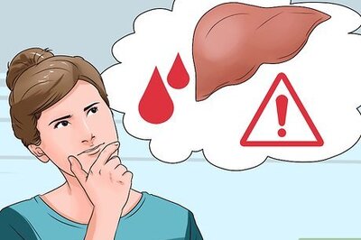 How to Treat Hepatitis B